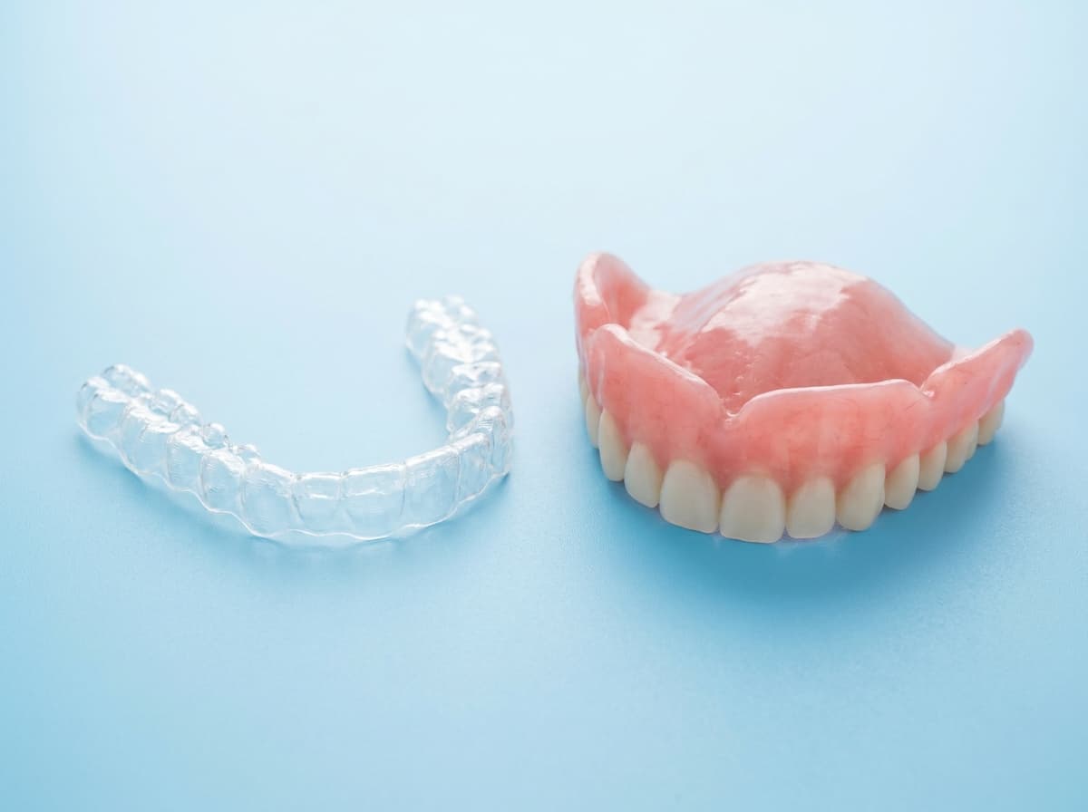 Implant-retained restoration representing the choice of an experienced clinician.